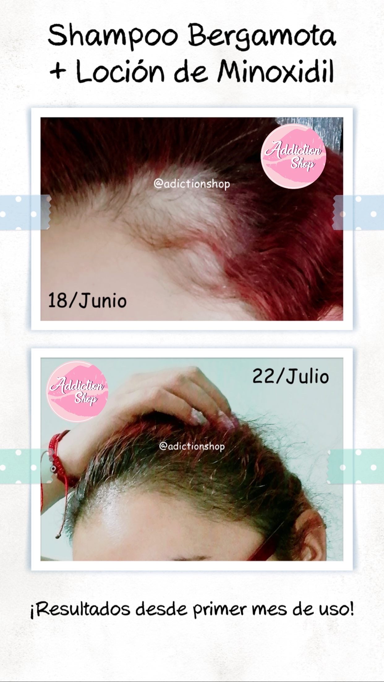 Kit Plus* - Anticaída + Crecimiento reforzado