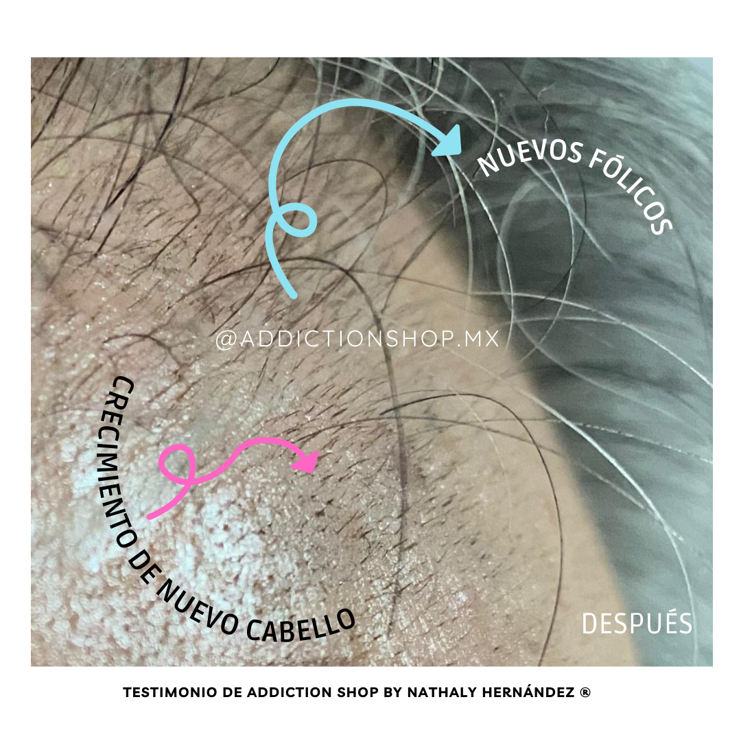 Kit Plus* - Anticaída + Crecimiento reforzado