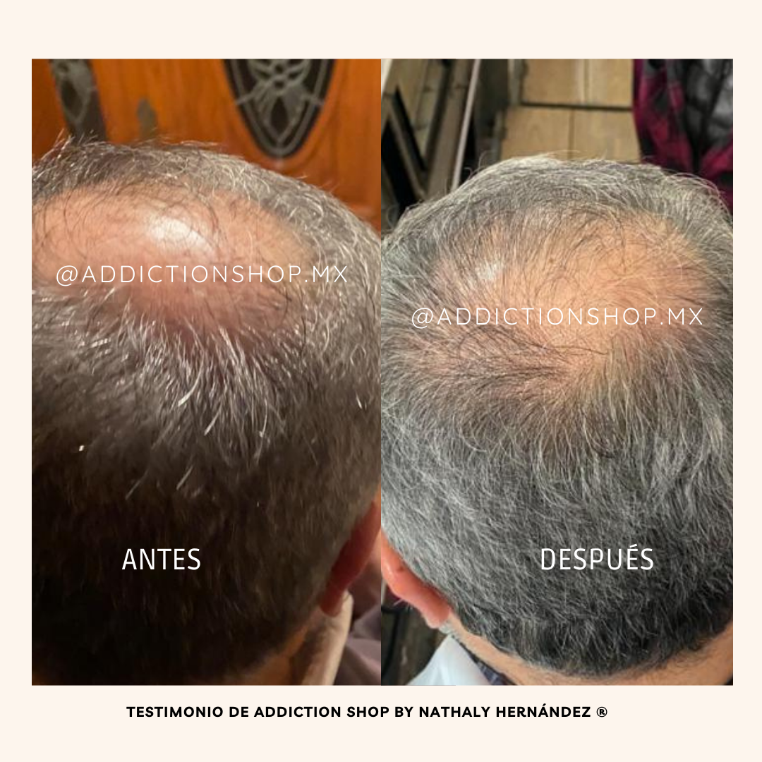 Kit Plus* - Anticaída + Crecimiento reforzado