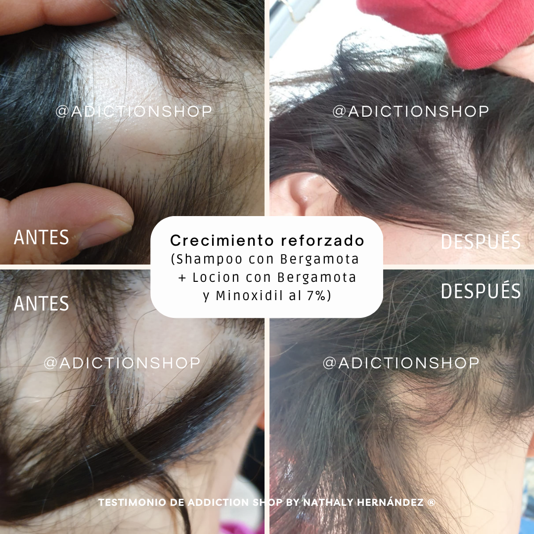Kit Básico - Anticaída + Crecimiento Reforzado